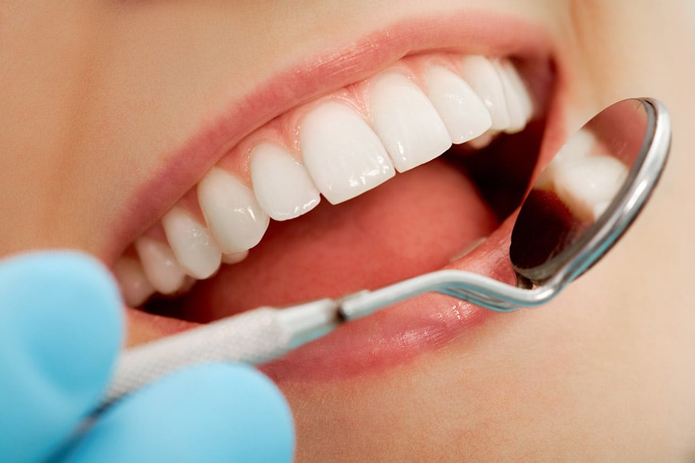 dental fillings with tooth colored material to maintain the teeth's natural appearance